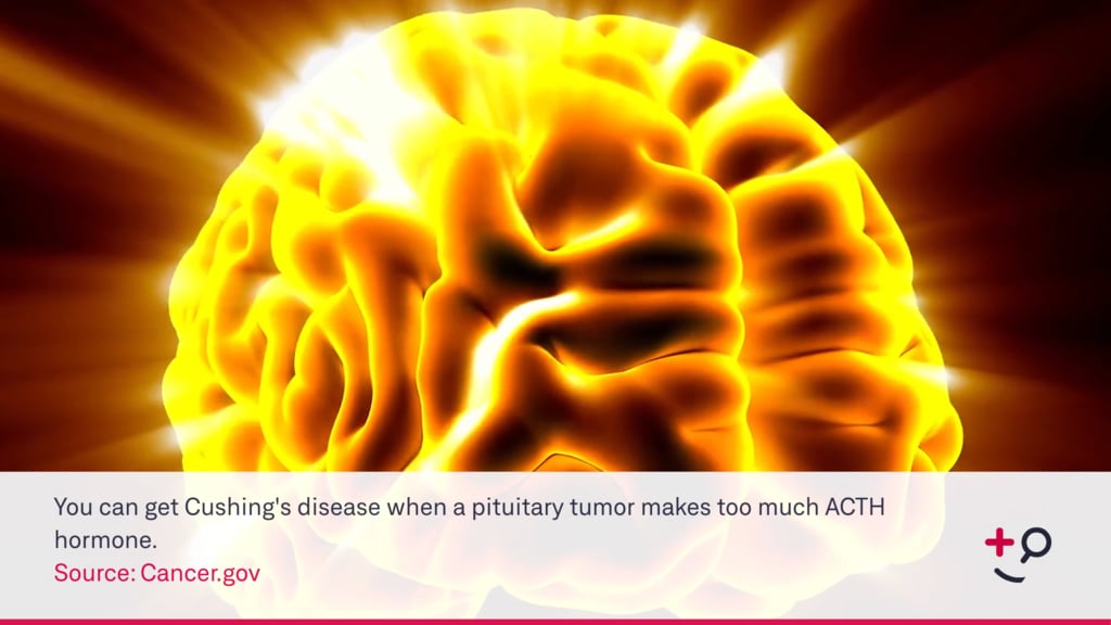 pituitary-tumor-different-hormones-doctorpedia