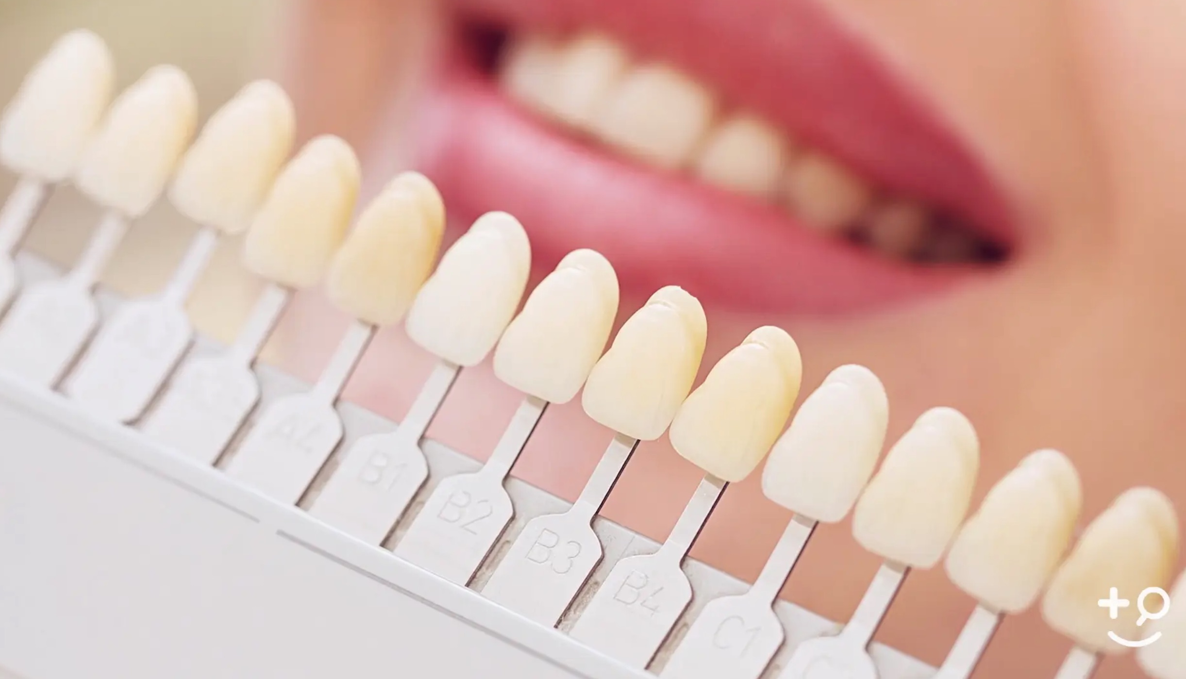 Teeth Whitening - Outcomes - Doctorpedia Doctor-Reviewed Video