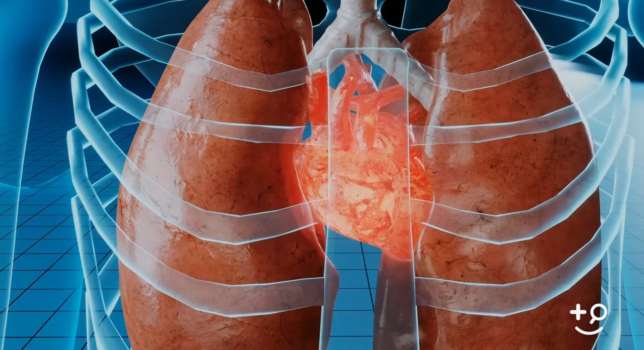 Heart Murmurs - Pulmonary Stenosis - Doctorpedia